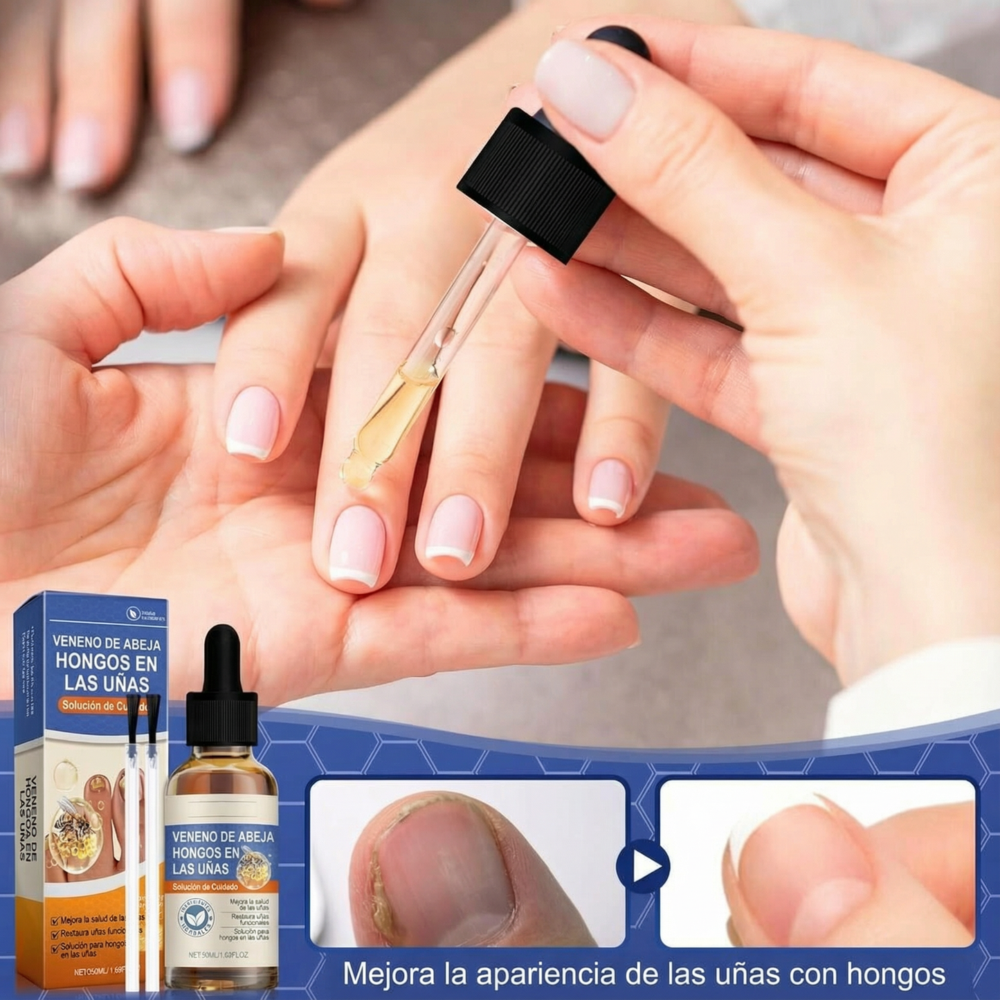 Sérum para Uñas con Veneno de Abeja – Tratamiento Antihongos y Cuidado Intensivo